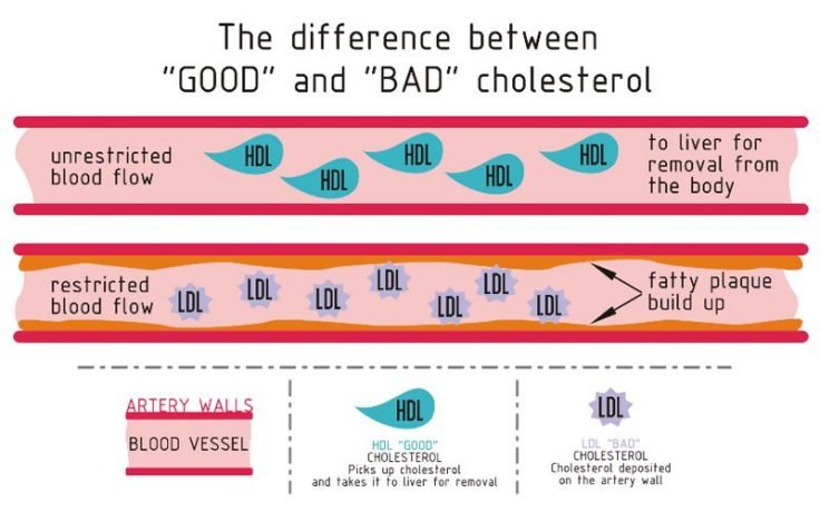 The Difference Between Good And Bad Cholesterol