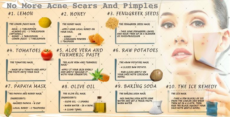 Acne Scars And Pimples