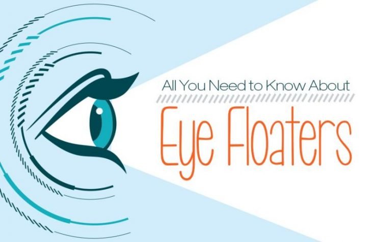 Eye Floaters