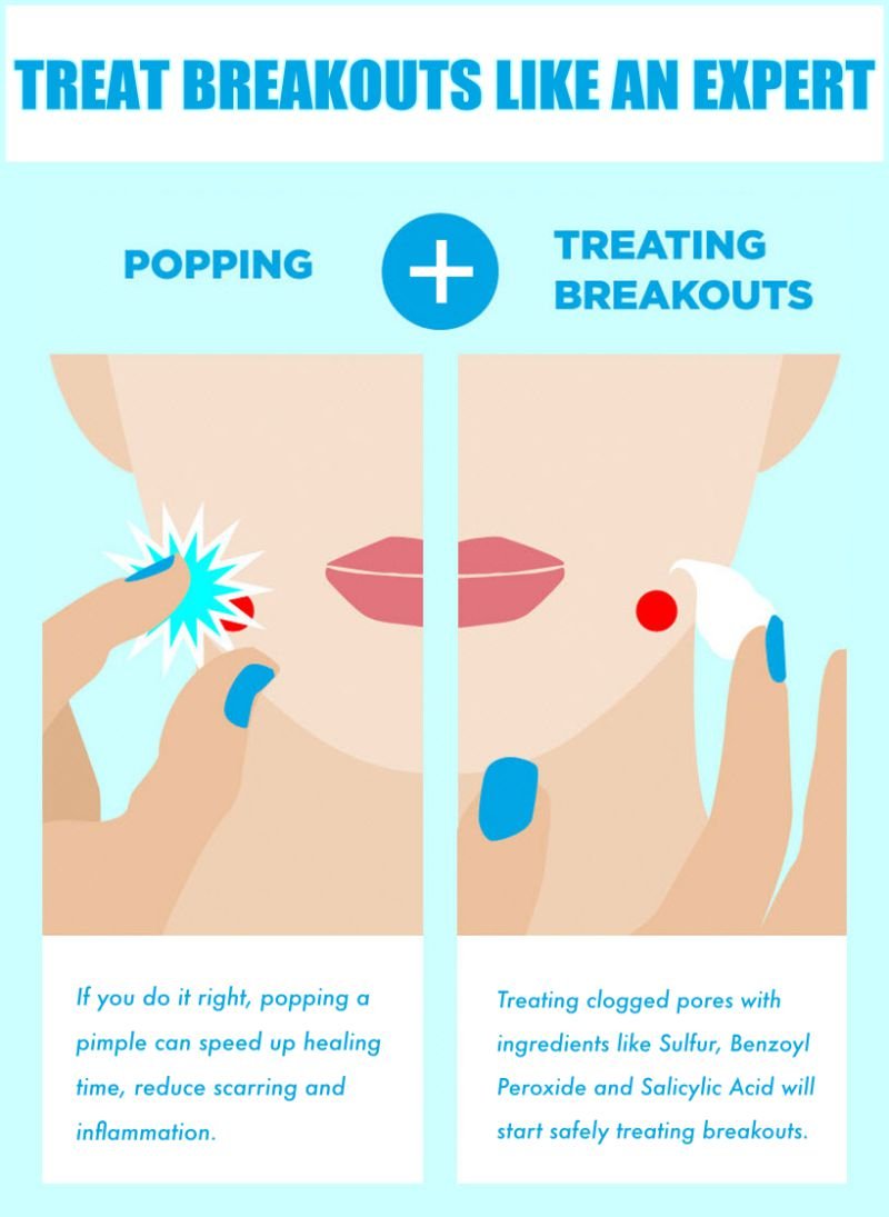 Treat Breakouts Like An Expert