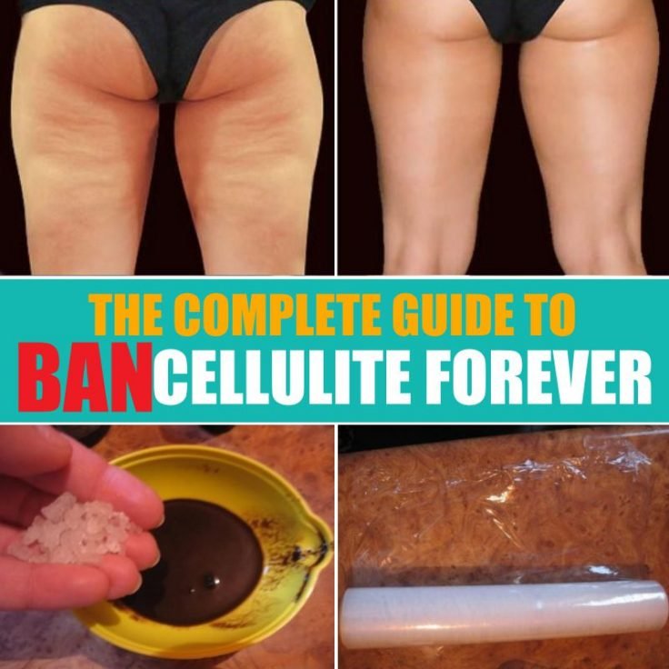 Guide To Ban Cellulite