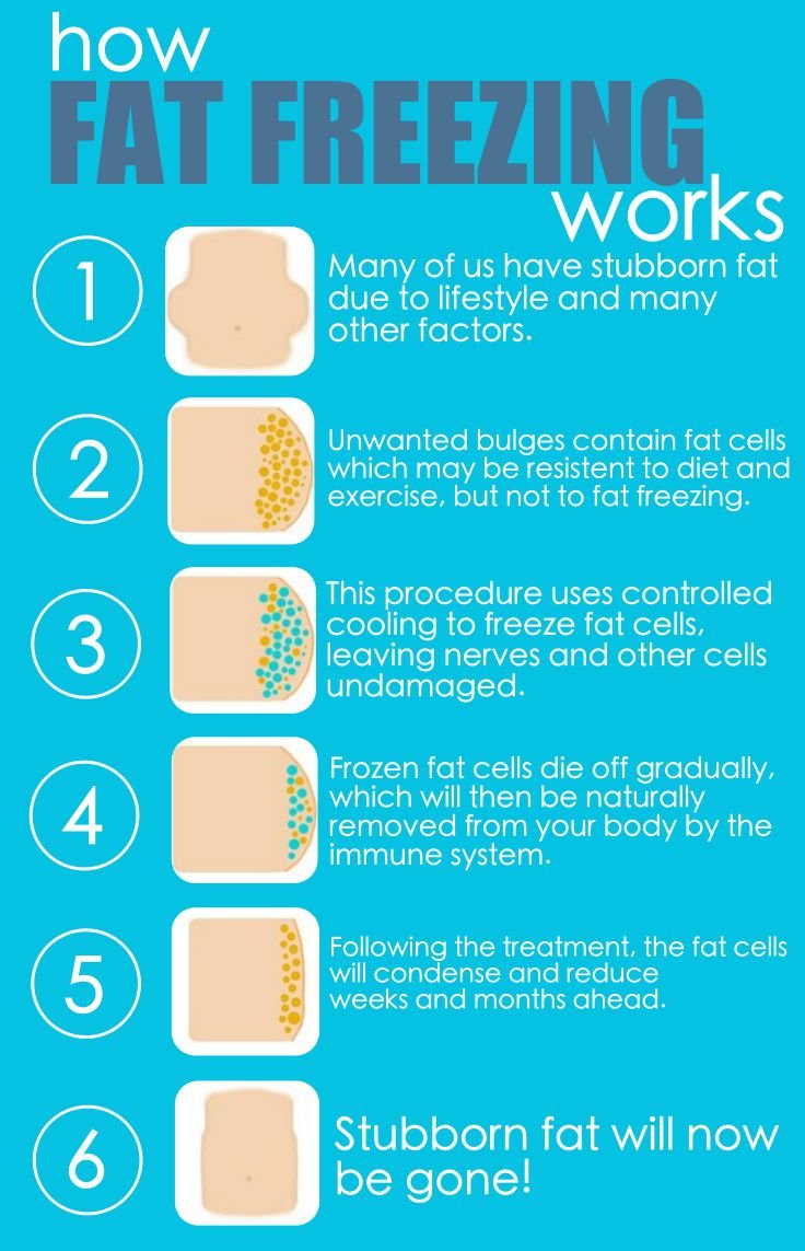 How Fat Freezing Works