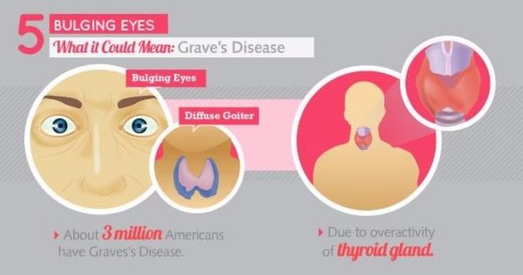 What Your Eyes Reveal About Your Wellbeing - Fitneass