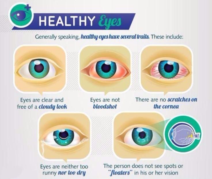 Healthy Eyes