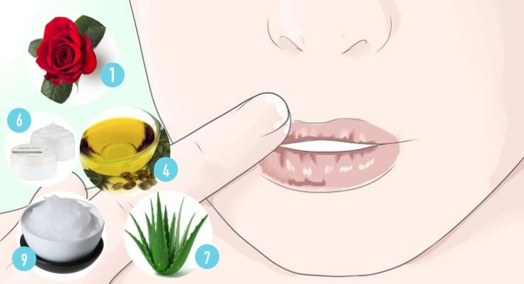 10-home-remedies-for-dry-cracked-lips