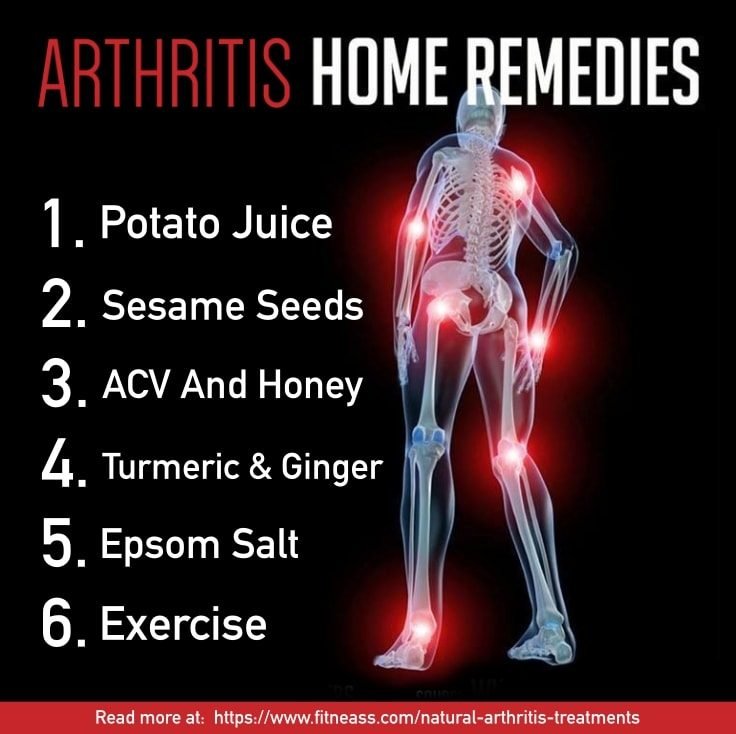 Natural Arthritis Treatments