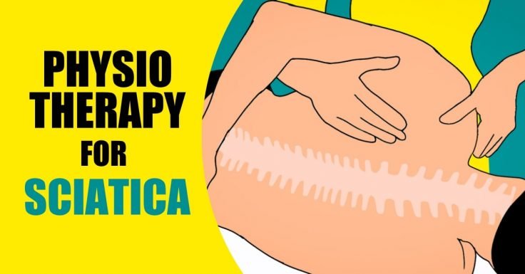 Physiotherapy can help you treat sciatica.