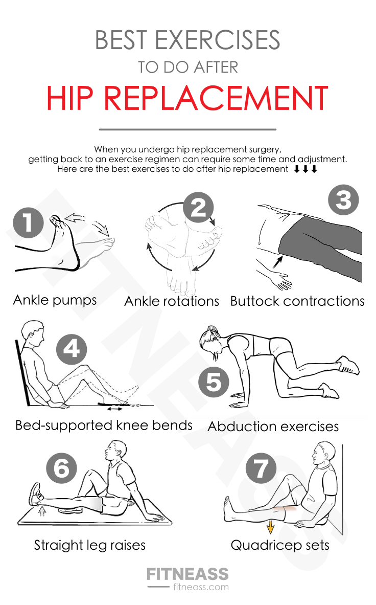 Post Hip Replacement Exercises