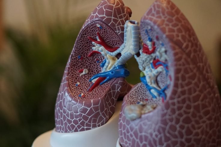 Signs Of Pulmonary Embolism And What You Need To Do