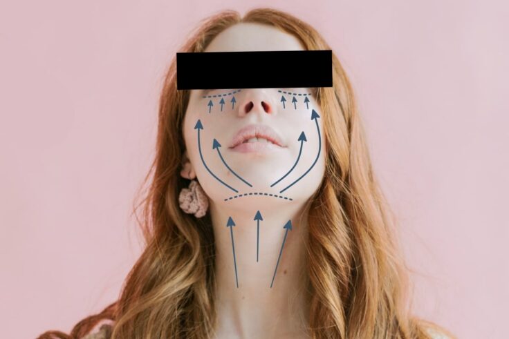 What To Consider Before Undergoing A Facelift Procedure