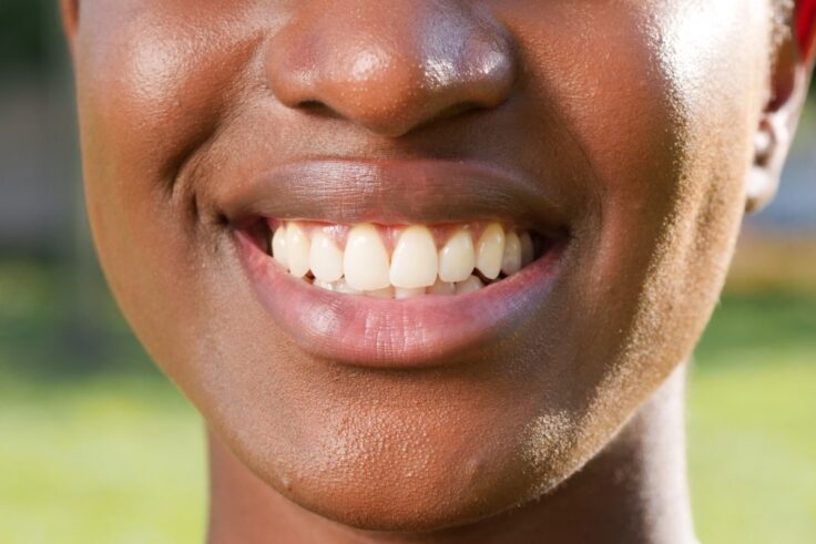 The most popular teeth straightening options