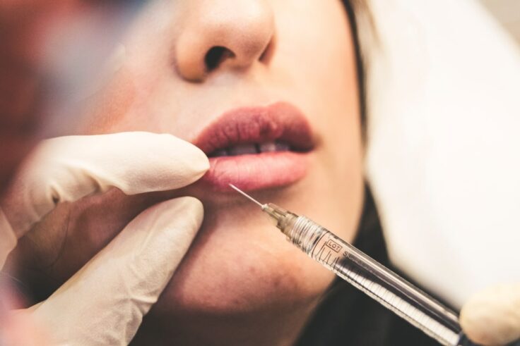 5 Ways Dermal Fillers Can Make You Look Instantly Younger