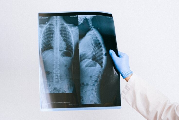 All You Need To Know About Medical X-Rays